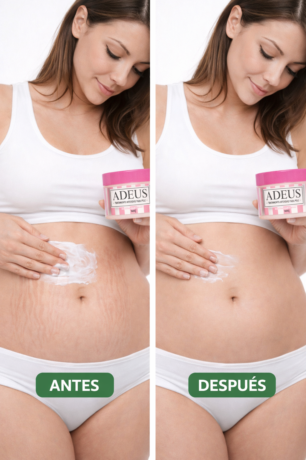 Oferta única: Adeus, la crema viral de Tiktok elimina estrias + OBSEQUIO ESPECIAL SOLO POR HOY